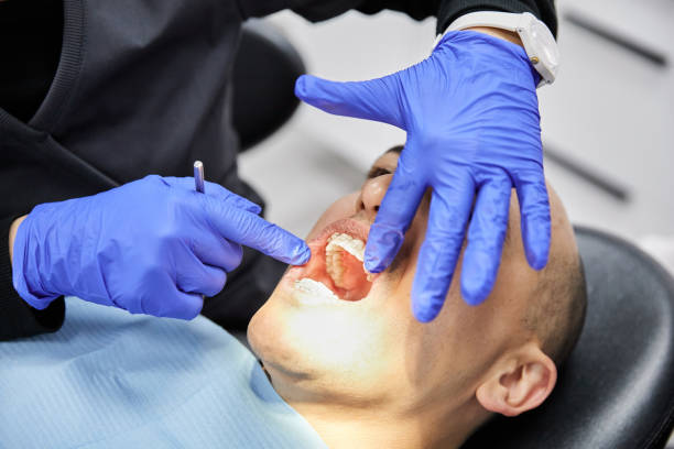 Best Emergency Dental Care for Trauma or Injury in Los Altos Hills, CA